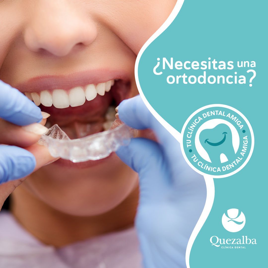 ¿Cómo puedes saber si necesitas ortodoncia?