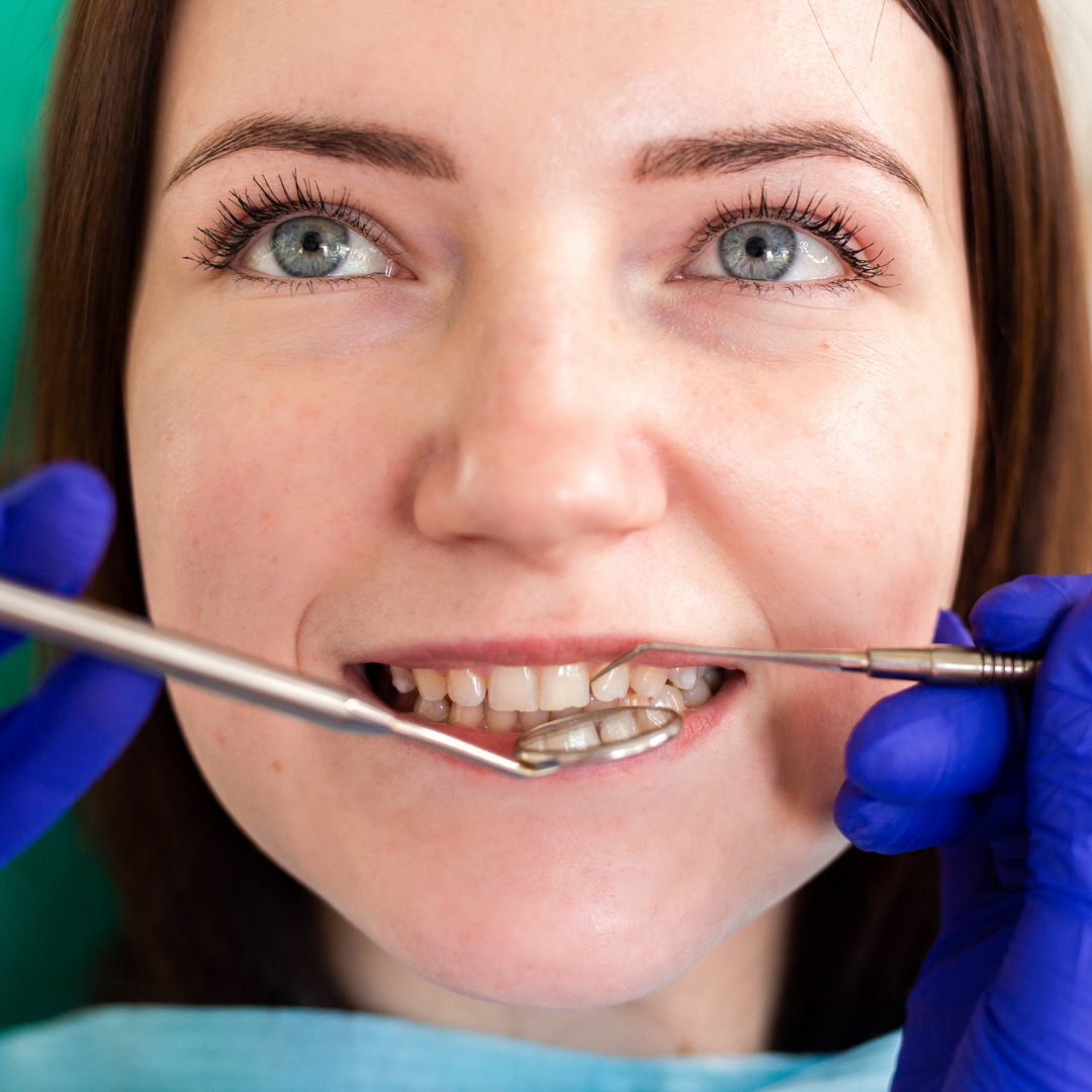 ¿Por qué es necesario realizarse dos revisiones dentales al año?
